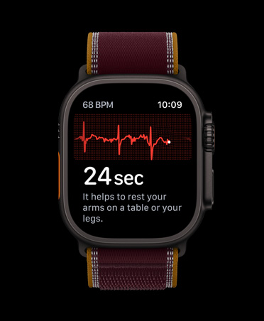 Apple Watch Ultra 4 ECG screen